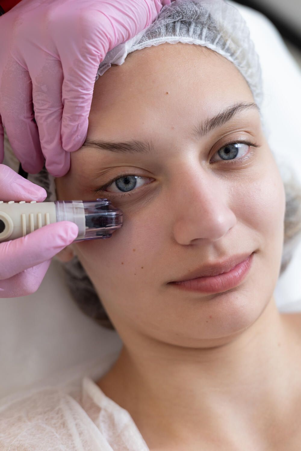 Μεσοθεραπεία Dermafrac αποκλειστικά από την Κόλντηρη Ελπίδα: BSc, MSc Αισθητικός - Κοσμητολόγος