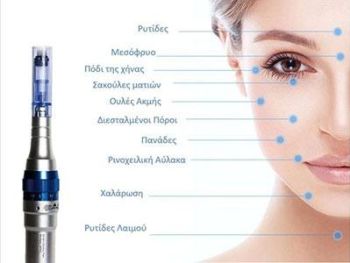 DermaPen - Microneedling - Μεσοθεραπεία - Miss Skin