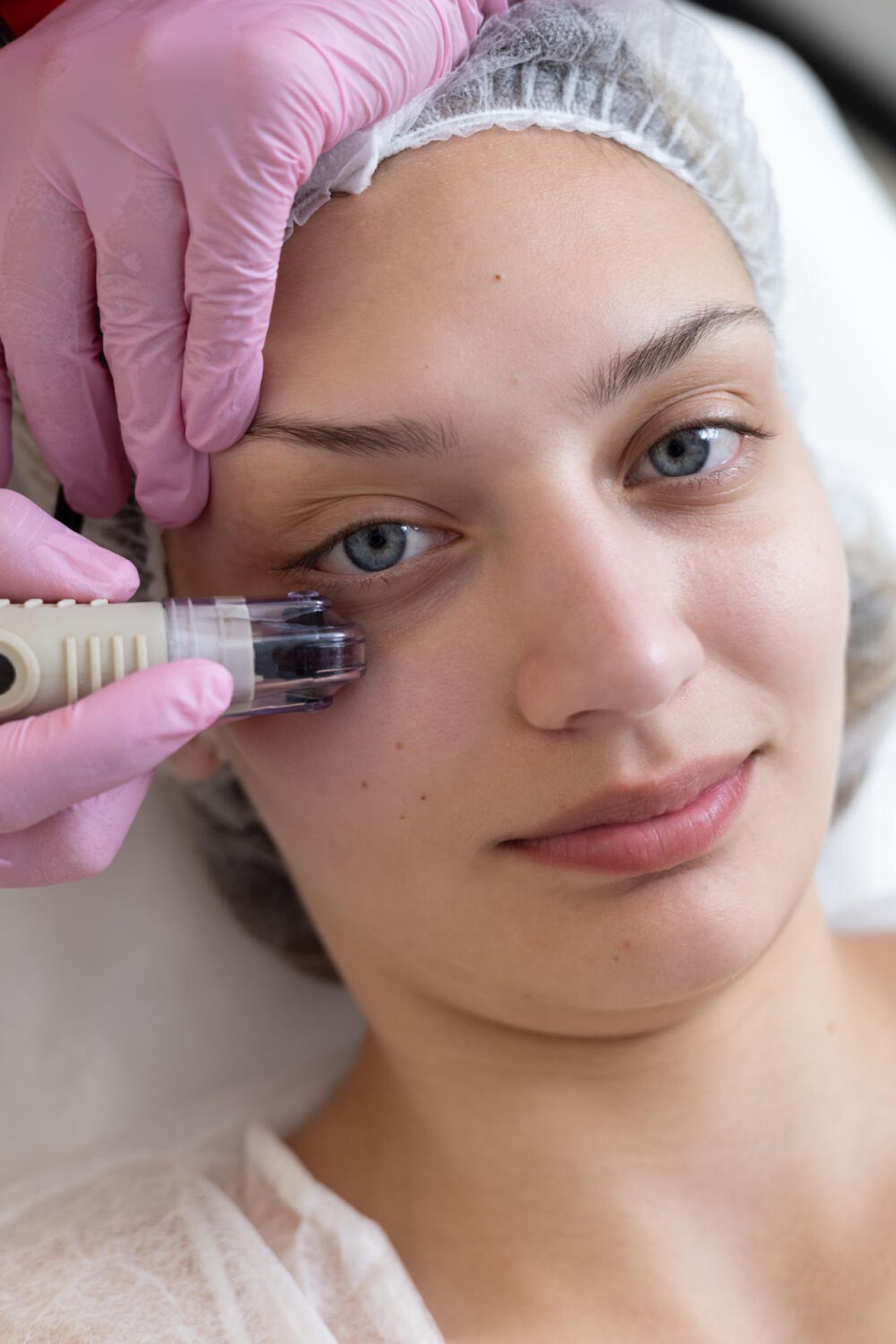 Μεσοθεραπεία Dermafrac αποκλειστικά από την Κόλντηρη Ελπίδα: BSc, MSc Αισθητικός - Κοσμητολόγος
